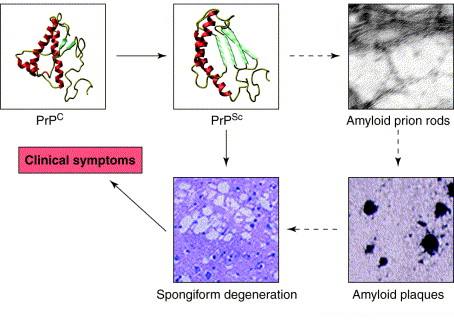 549_Prions and transmissible spongiform encephalopathies.png